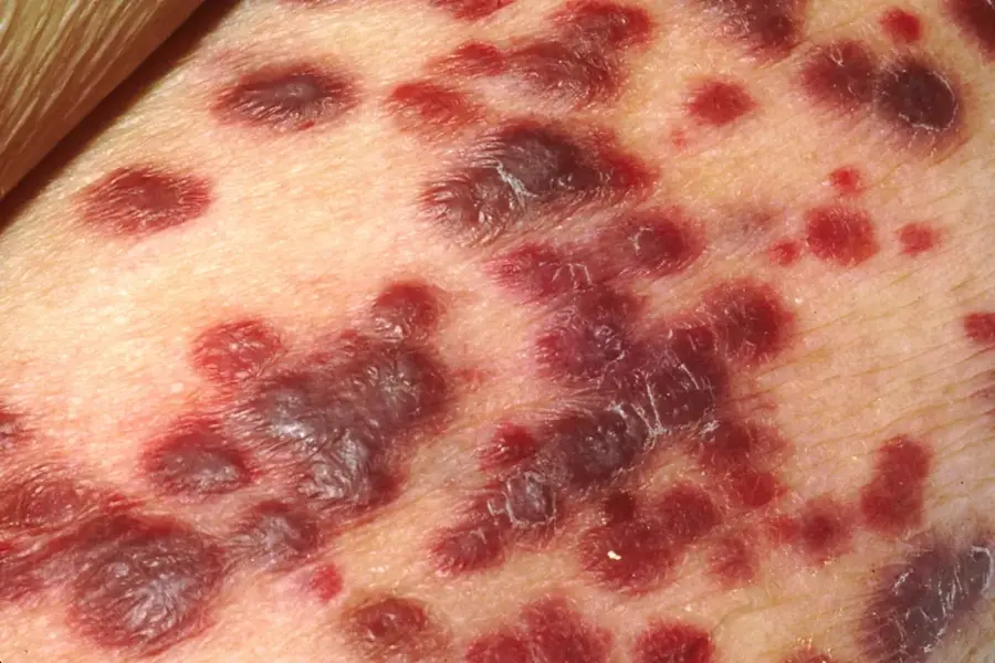 Kapos — Szigetvár (Magyarország)